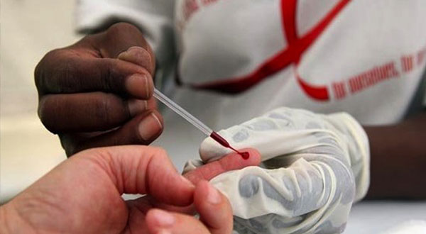 علاج اختباري ناجع لمرض الإيدز