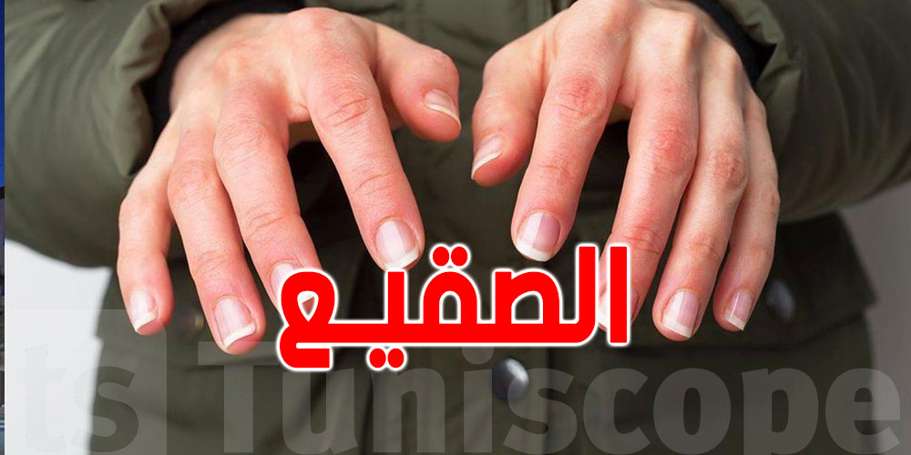 ''الصقيع'': أسبابه...أعراضه والعلاج