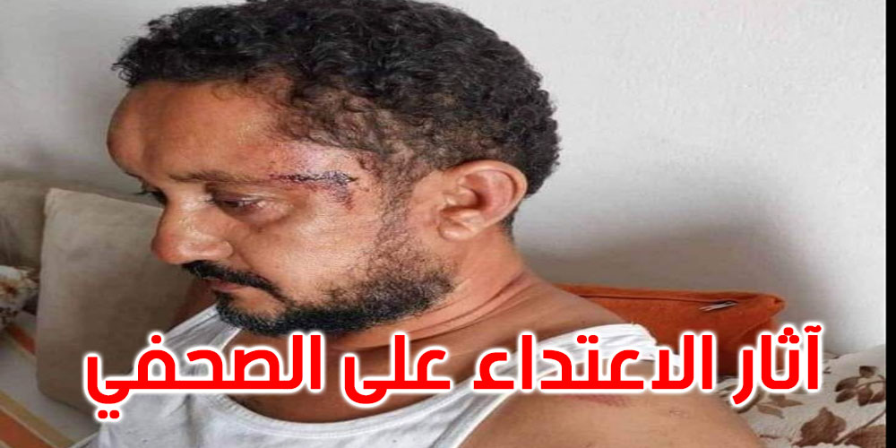 نقابة الصحفيين: اعتداء أمني همجي على سفيان بن نجيمة