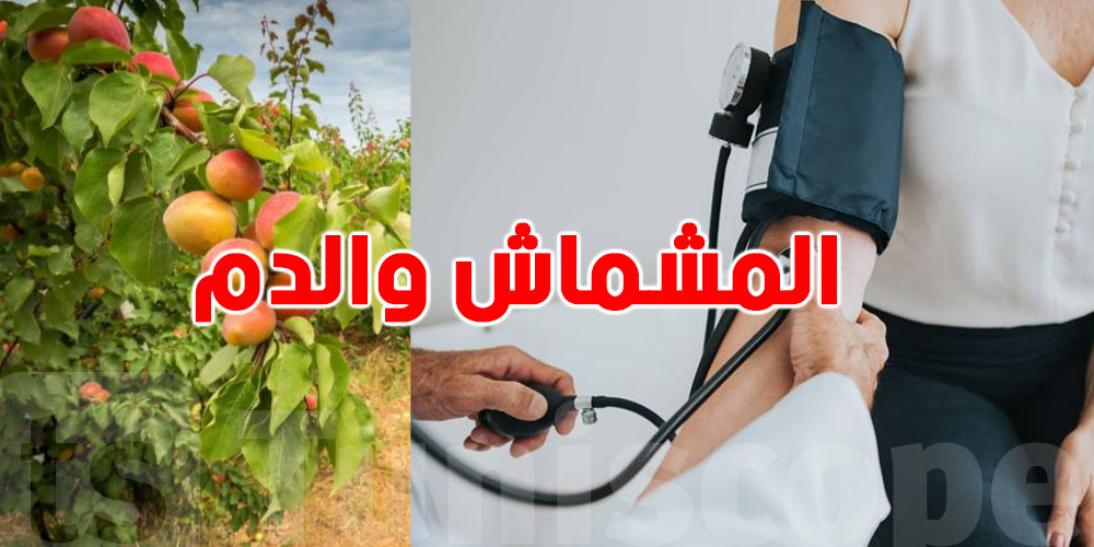 المشمش وضغط الدم: مفيد ولا فيه مخاطر؟