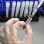 اكتشاف حالة إصابة بمرض السل في المدرسة العليا للفلاحة بماطر
