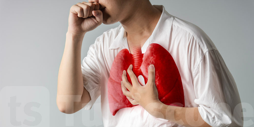 Santé publique : entre 1 400 et 1 500 cas de tuberculose recensés chaque année en Tunisie