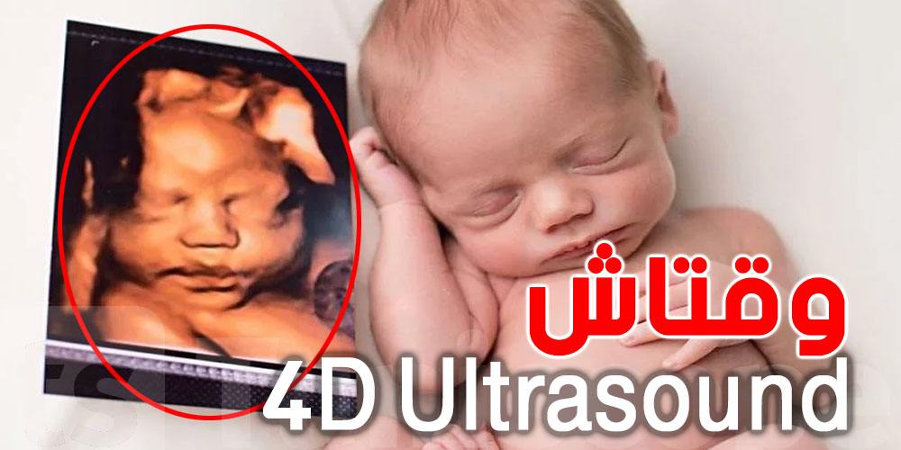 شنّوة الوقت المثالي لإجراء الأشعة رباعية الأبعاد 4D Ultrasound؟