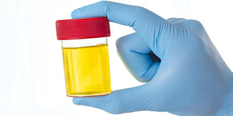 Des briques fabriquées à partir d’urine humaine en Afrique du Sud