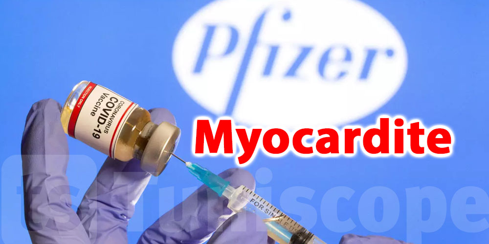 Plusieurs cas de myocardite après le vaccin Pfizer en France