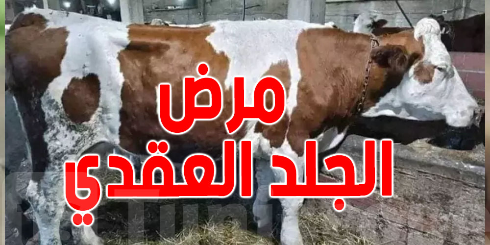 مرض غريب يرعب الدول العربية المجاورة ...هل وصل الى تونس ؟