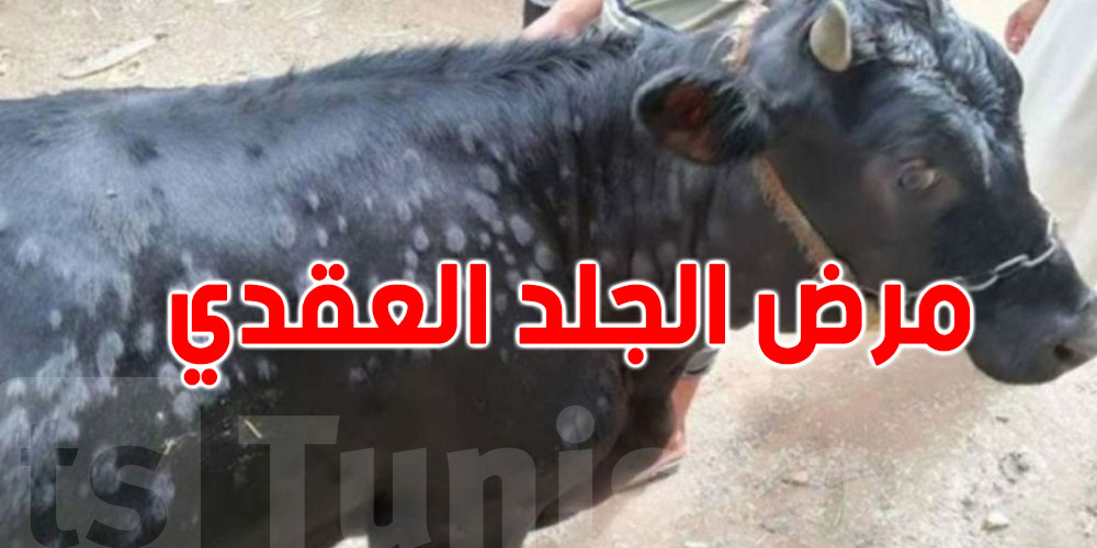 بعد تسجيل أول إصابة.. هل مرض الجلد العقدي عند الأبقار معد للإنسان ؟