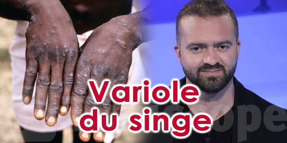 Variole du singe en Tunisie ? Zakaria Bouguira répond 