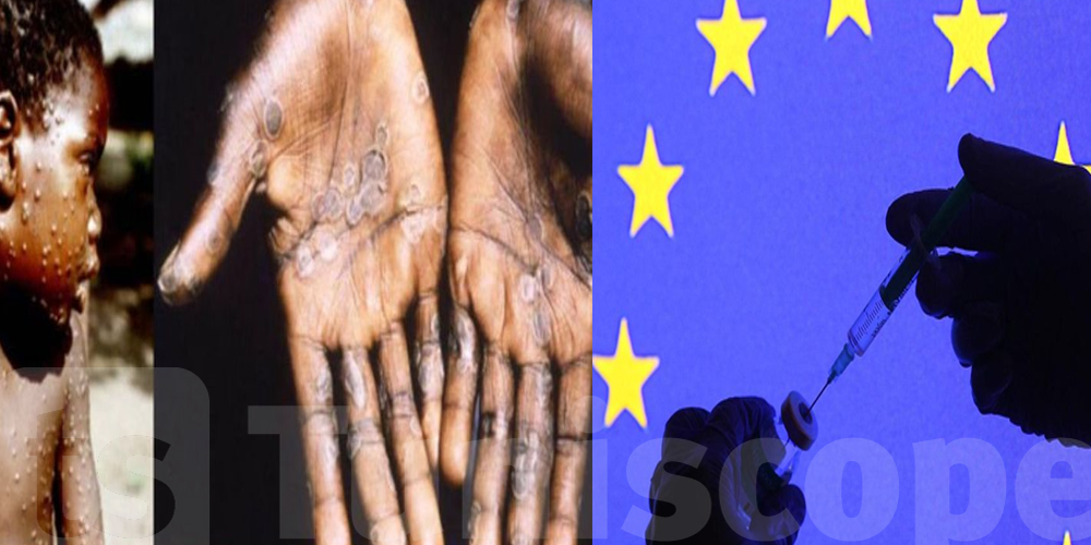 Variole du singe : l'UE prépare des achats groupés de vaccins