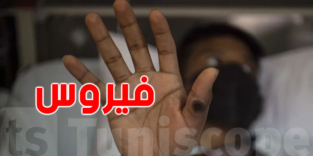 فيروس الورم الحليمي مش جنسي فقط: موجود في اليدين، في الفمّ وحتى في القماش!
