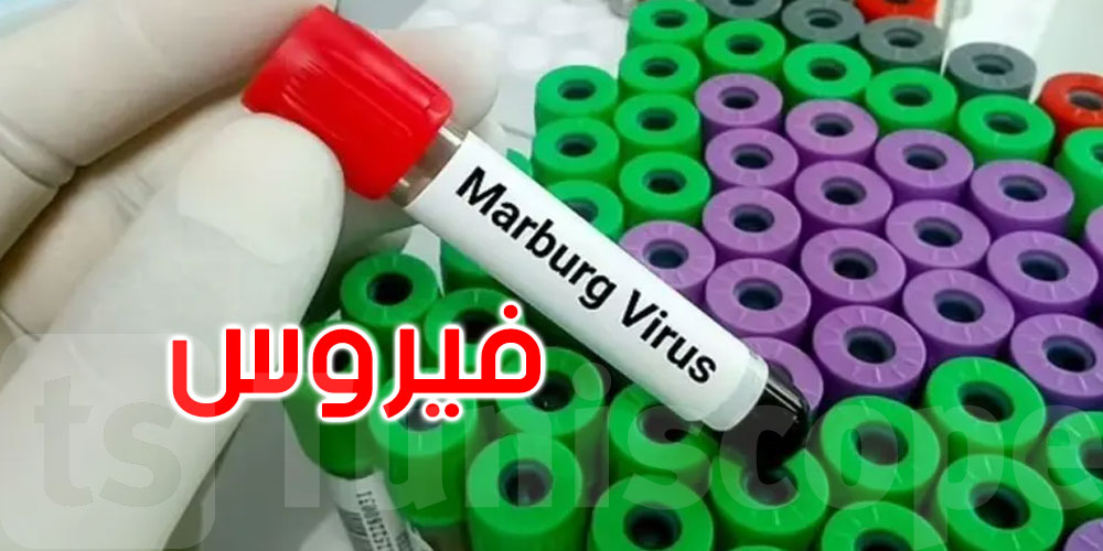 بعد انتشاره في هذه الدولة.. ماذا نعرف عن فيروس ‘ماربورغ’؟