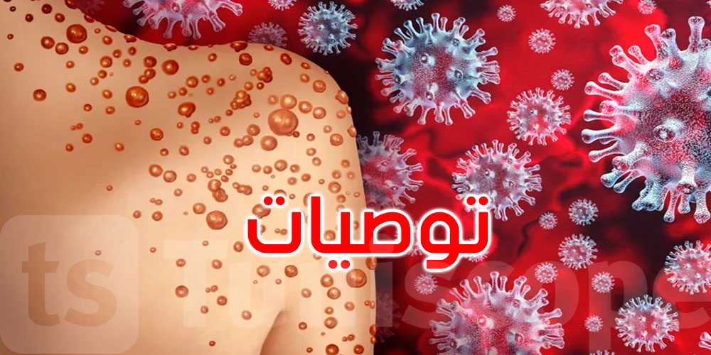 جدري القردة: بماذا توصي منظمة الصحة العالمية بشأن السفر؟