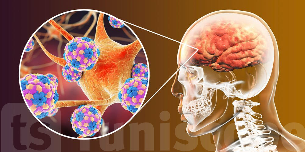 أثار القلق في القيروان : نصائح طبية مهمة للوقاية من الـ Méningite