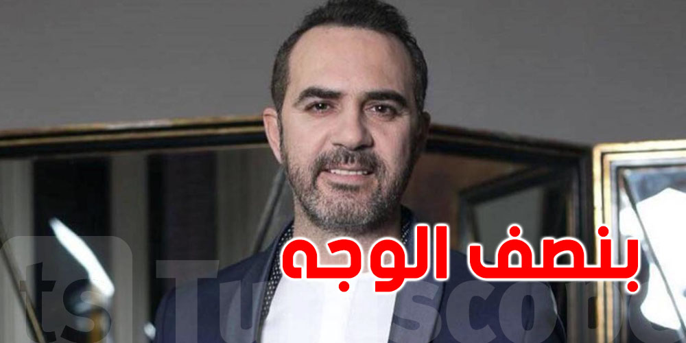 وائل جسار: خضعت لجراحة تجميل في نصف الوجه