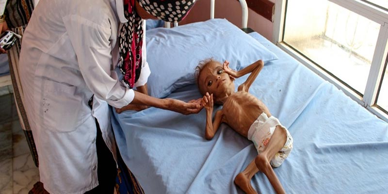 Au Yémen, un enfant meurt toutes les dix minutes, alerte l'Unicef