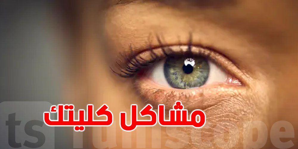عينك تكشف مشاكل كليتك… إنتبه!