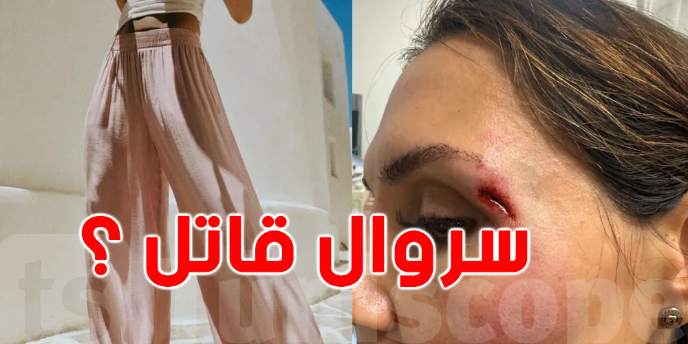 عاجل : سروال'' زارا القاتل '' يقلب الدنيا ...شوف الحكاية قبل ما تشريه